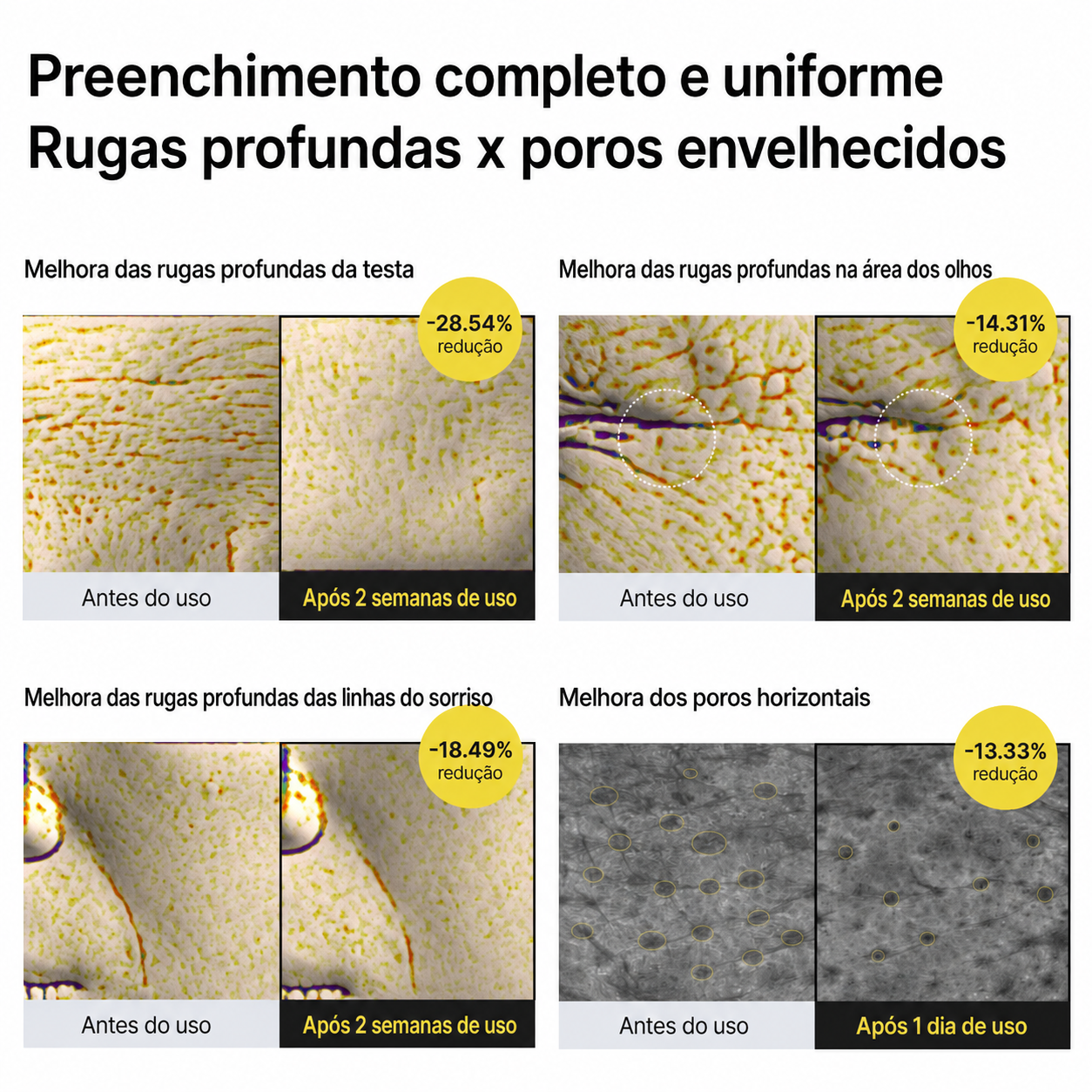 Material promocional do Celimax mostrando comparações antes e depois em linhas e poros